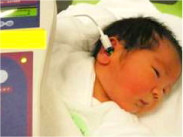 新生児聴覚検査スクリーニング